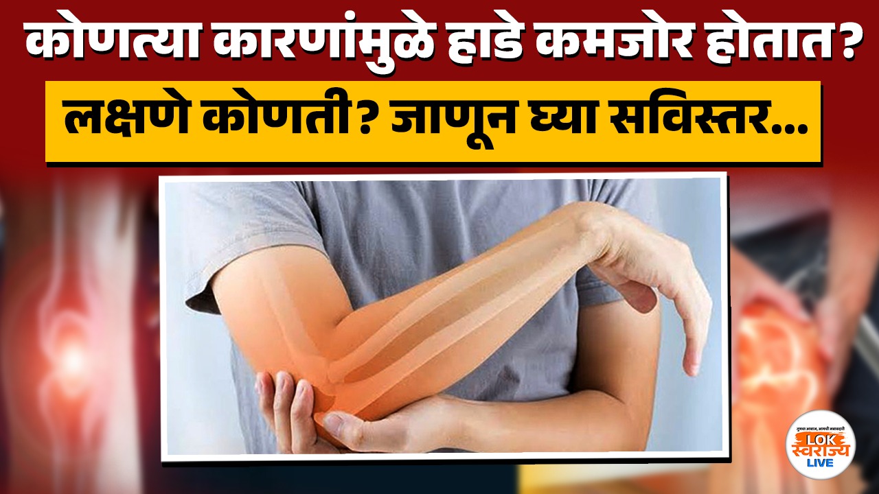 कोणत्या कारणांमुळे हाडे कमजोर होतात? लक्षणे कोणती? जाणून घ्या सविस्तर…